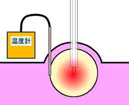 広拡散プローブ法